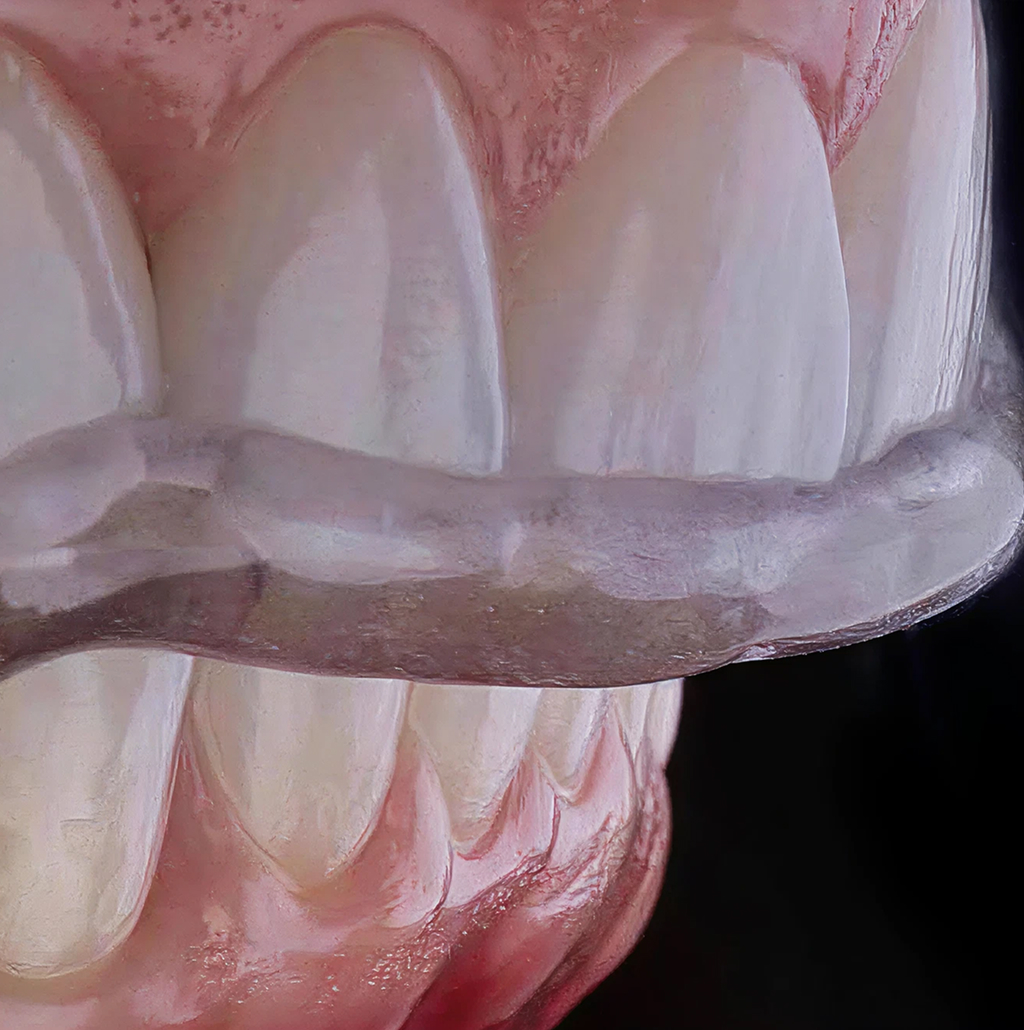 Transformação sorriso Caso 02 — BCX Odontologia